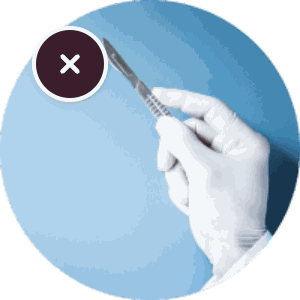 NON-surgical correction